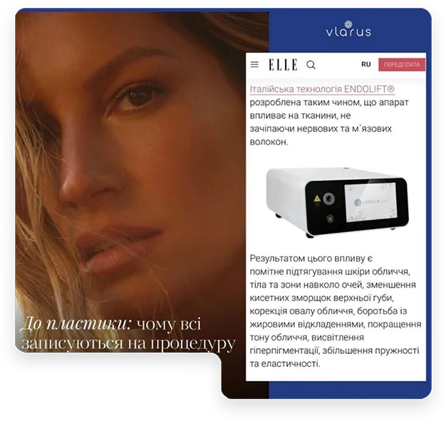 Халықаралық баспасөздің Lasemar 1500 Endolift лазерлік жүйесі туралы пікірлері